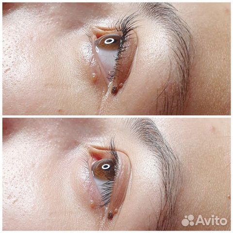 Ламинирование и ботокс ресниц Ламинирование и ботокс ресниц